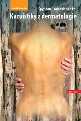 Kazuistiky z dermatologie