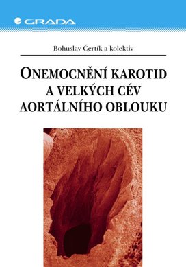 Onemocnění karotid a velkých cév aortálního oblouku