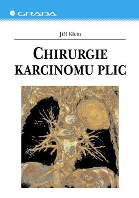 Chirurgie karcinomu plic