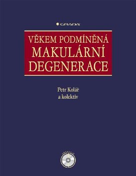 Věkem podmíněná makulární degenerace
