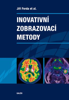 Inovativní zobrazovací metody