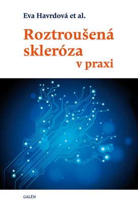 Roztroušená skleróza v praxi