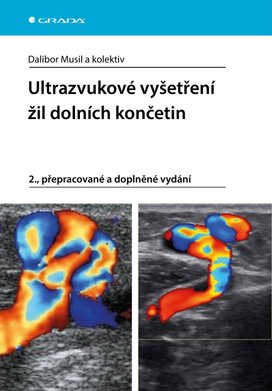 Ultrazvukové vyšetření žil dolních končetin