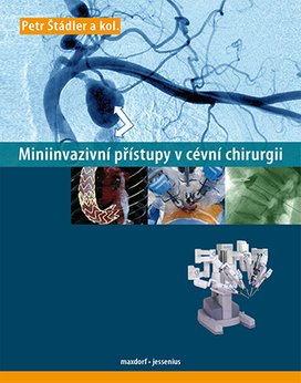 Miniinvazivní přístupy v cévní chirurgií