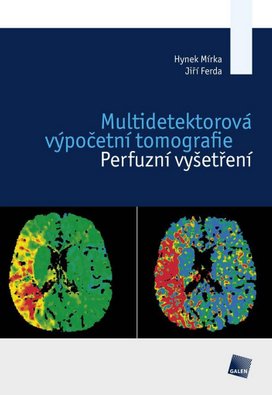 Multidetektorová výpočetní tomografie