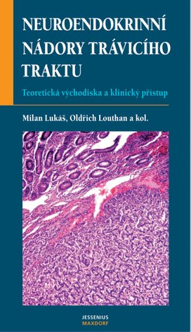 Neuroendokrinní nádory trávicí