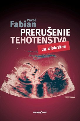Prerušenie tehotenstva