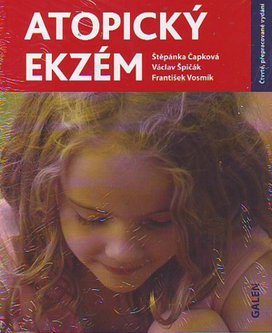 Atopický ekzém