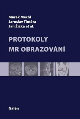 Protokoly v MR zobrazování