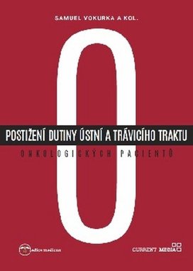 Postižení dutiny ústní a trávicího traktu onkologických pacientů