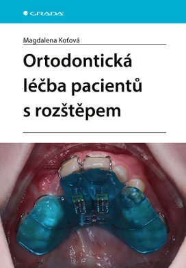Ortodontická léčba pacientů s rozštěpem