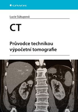 CT - Průvodce technikou výpočetní tomografie