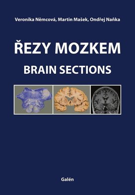 Řezy mozkem